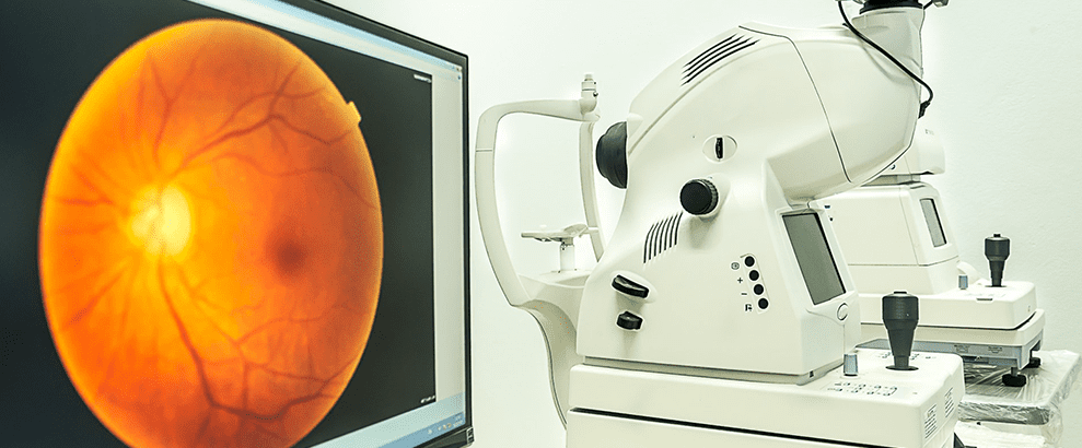 A computer screen showing an image of a retinal scan next to two Optomap Retinal Scan machines 